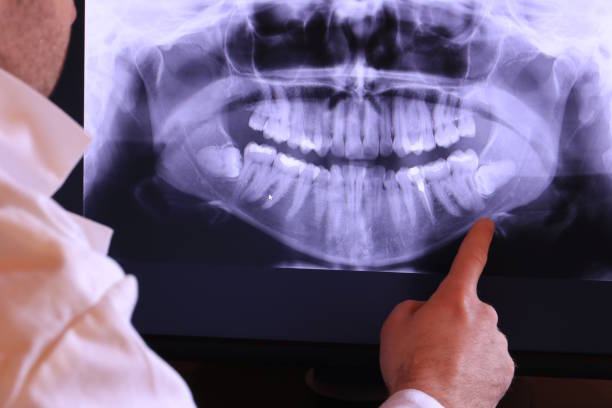 Best Emergency Treatment for Jaw Pain or Injury in Marfa, TX